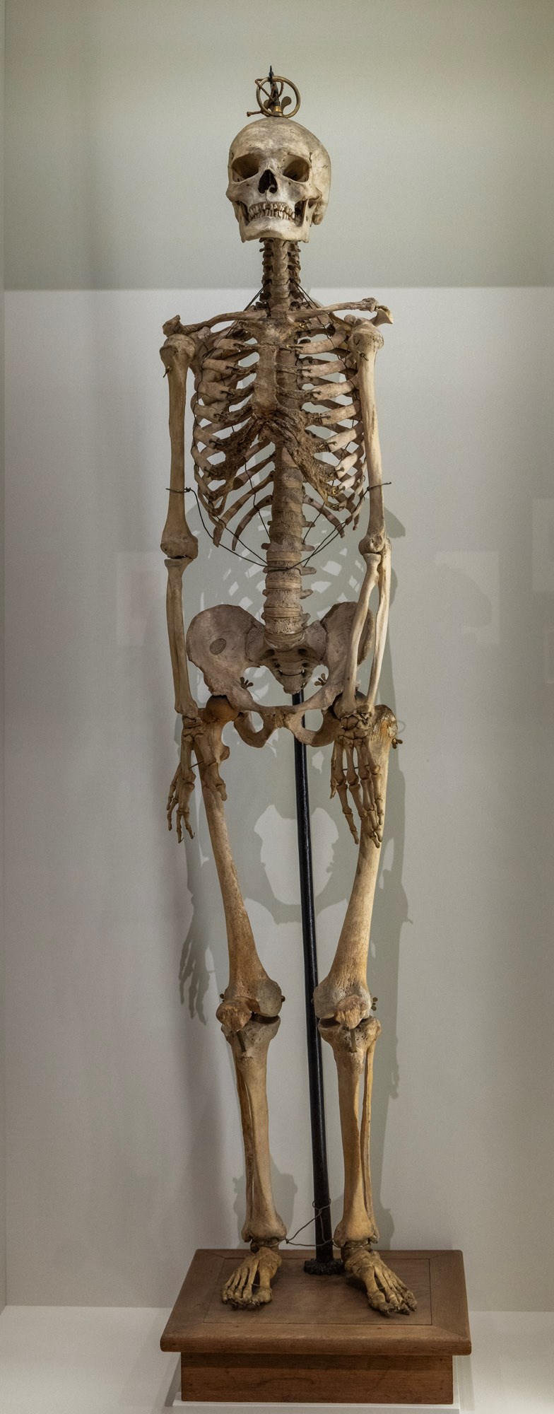 Montert menneskeskjelett på sokkel, brukt i anatomitrening. Lånt fra Teknisk Museum. Skjelettet knytter an til Munchs interesse for anatomi. Knoklene bærer preg av alder, med noe mørk misfarging på brystkassen.